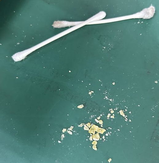 書き出したノズルの残骸